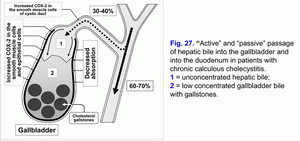Active and passive passage of hepatic bile, chronic calculous cholecystitis
