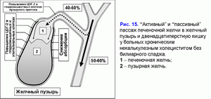 Активный и пассивный пассаж печеночной желчи, хронический некалькулезный холецестит без билиарного сладжа