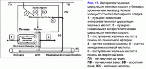Энтерогепатическая циркуляция желчных кислот, хронический некалькулезный холецестит без билиарного сладжа