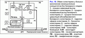 Обмен холестирина, хронический некалькулезный холецестит без билиарного сладжа