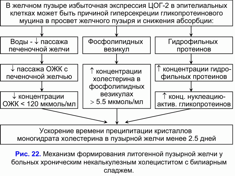 Некалькулезный холецистит лечение. Схема лечения некалькулезного хронического холецистита. Хронический холецистит патогенез схема. Алгоритм диагностики острого калькулезного холецистита. Патогенез калькулезного холецистита.