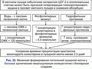 Формирование литогенной пузырной желчи, хронический некалькулезный холецестит, билиарный сладж