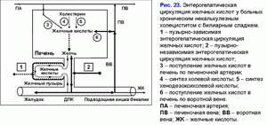 Энтерогепатическая циркуляция желчных кислот, хронический некалькулезный холецестит, билиарный сладж