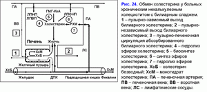 Обмен холестирина, хронический некалькулезный холецестит, билиарный сладж