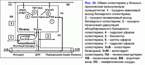 Обмен холестирина, хронический калькулезный холецестит