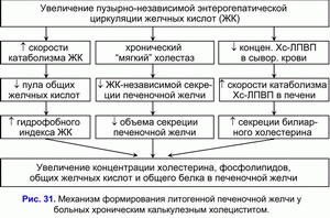 Формирование литогенной печеночной желчи, хронический калькулезный холецестит