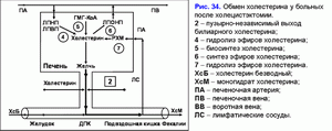 Постхолецистэктомический синдром, обмрн холецтерина