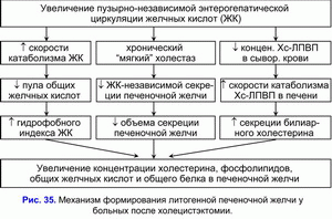 Постхолецистэктомический синдром, формирование литогенной желчи