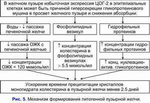 Механизм формирования литогенной пузырной желчи