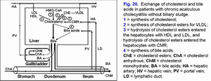 Cholesterol and bile acids metabolism, chronic acalculous cholecystitis without biliary sludge