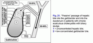 Passive passage of hepatic bile, chronic acalculous cholecystitis, biliary sludge