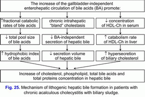Lithogenic hepatic bile formation, chronic acalculous cholecystitis, biliary sludge