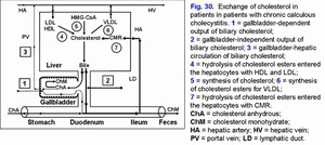 Cholesterol metabolism, chronic calculous cholecystitis