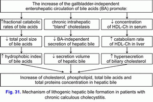 Lithogenic hepatic bile formation, chronic calculous cholecystitis