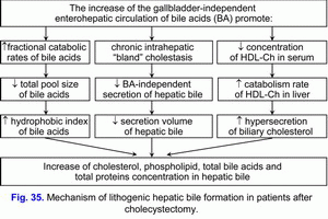Mechanism of lithogenic bile formation,  cholecystectomy