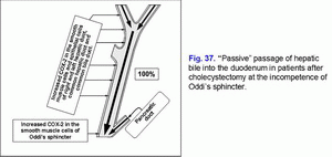 Passive passage of hepatic bile, incompetence of Oddi's sphincter, cholecystectomy