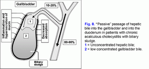 Passive passage of hepatic bile, chronic acalculous cholecystitis, biliary sludge