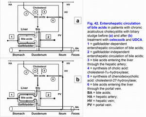 Enterohepatic circulation of bile acids, chronic acalculus cholecystitis, biliary sludge