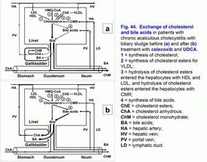 Exchange of cholesterol and bile acids, chronic acalculus cholecystitis, biliary sludge